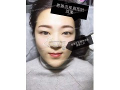 美丽人生从上海ES恩善韩式半永久化