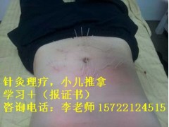 毕节市短期针灸推拿培训学费,免费针