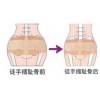 上海一指私密培训术哪家专业，上海有几家徒手术