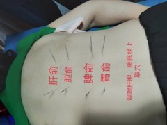 贵州安顺有学中医针灸推拿的培训班