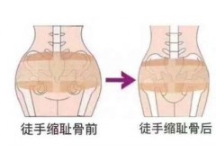龙岩十大专业一指私密培训学校