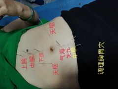在黔西南安龙县哪里有专业针灸推拿
