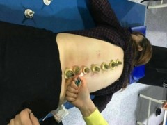 在黔东南锦屏县针灸推拿学习的人多