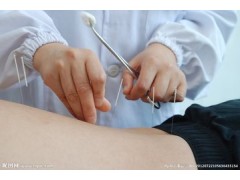 黔东南凯里学中医针灸康复理疗哪里
