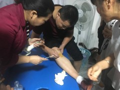 黔西南兴义哪里有比较好的针灸理疗