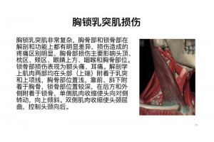 郑州肌筋膜松解术及疼痛的适应症
