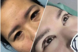 微整形行业培训学习微整哪个地方好呢