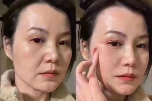 微整形学习培训学习微整那家好