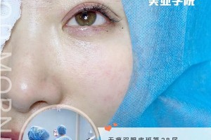 微整形培训院校学微整形在哪里学比较好