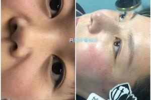 微整形培训学习微整正规培训那好