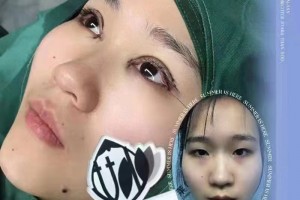 微整培训学习微整到哪呢