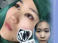 微整培训课微整形培训学费哪里好