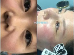 微整培训地址学微整哪里学习好