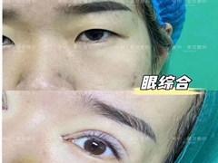 南京较好的注射美容培训